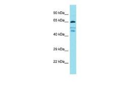 FIGNL2 Rabbit anti-Human, Polyclonal, Novus Biologicals 100 &mu;g | Buy Online | Novus Biologicals | Fisher Scientific